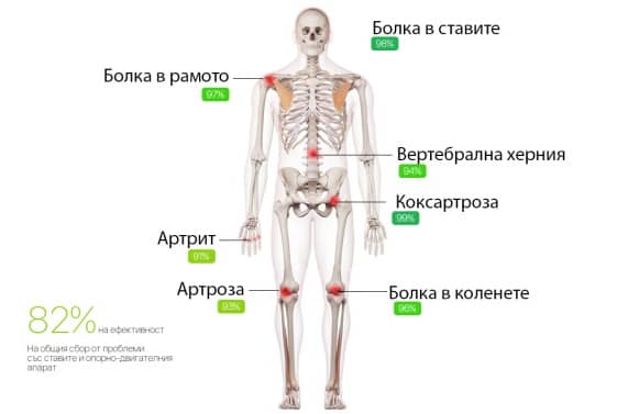 Артровекс човешки скелет с индикирани зони за болка по ставите