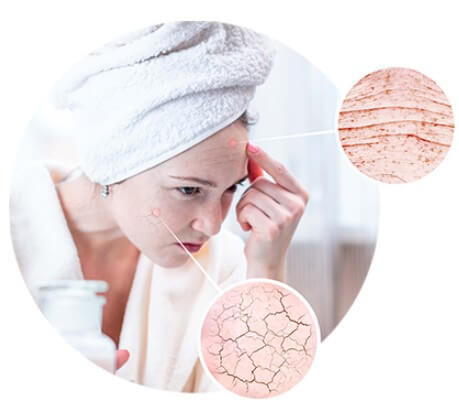 Dermolios инструкция за употреба - листовка Dermolios инструкция за употреба - листовка