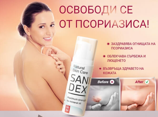 жена, псориазис, sanidex крем