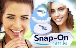 Snap-On Smile Мнения и Цена – Ефект?
 