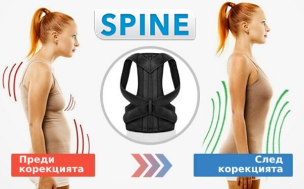 Spine Магнитен Коректор - Мнения и Коментари